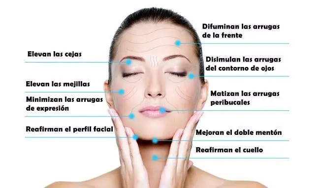 Hilos MONO – Hilos Tensores PDO (sobre con 10) - Image 4