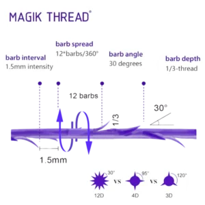 Magic Thread – Hilos Espiculados 12D COG Cánula (4 piezas)